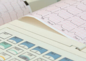EKG